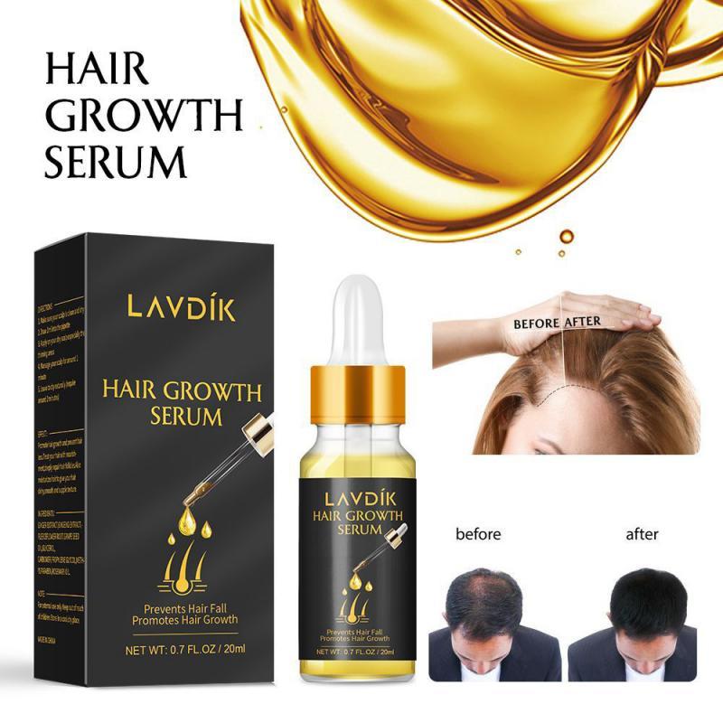 Hair Loss Prevention - Rapid & Natural Hair Growth